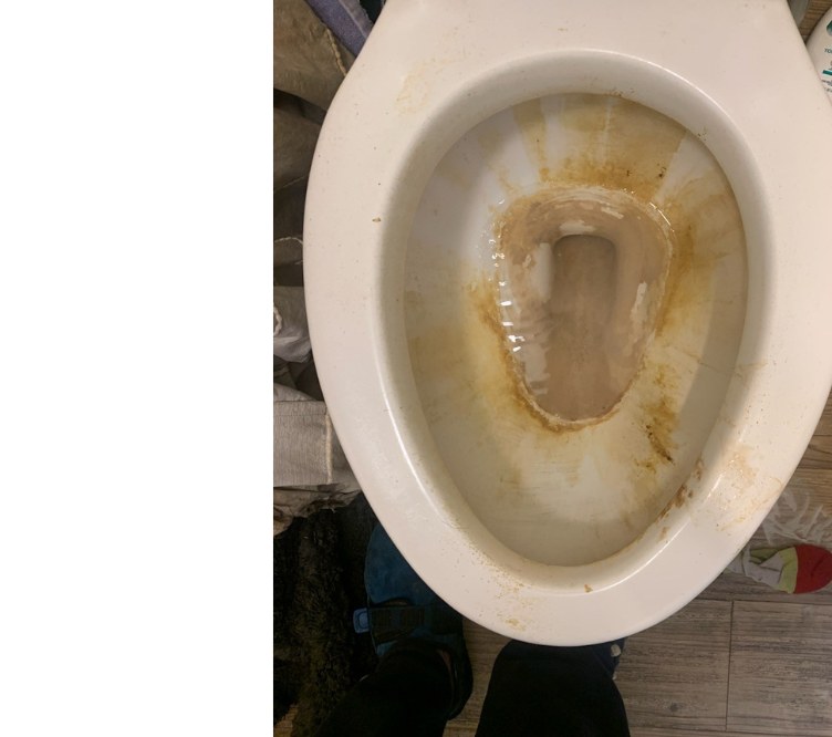 Toilet Sanitization before